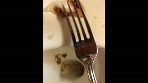 We did not find results for: Worms parasites mucus turpentine and coffee enemas - YouTube