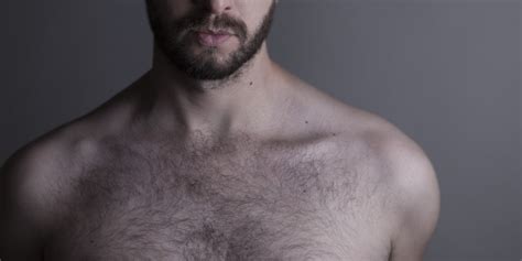 Both sexes have hair absoloutely everwhere on their bodies. Does a weak donor area make you incompatible for hair ...