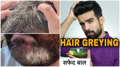 Put some coconut oil in a pan. PREMATURE HAIR GREYING|सफेद बाल| REVERSE GREY HAIR?|HAIR ...