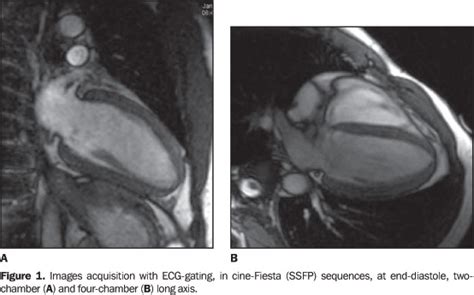 A ressonância magnética (rm), também conhecida por ressonância magnética nuclear (rmn), é um exame de imagem capaz de mostrar com definição as estruturas internas dos órgãos. Radiologia Brasileira - Qual o seu diagnóstico?