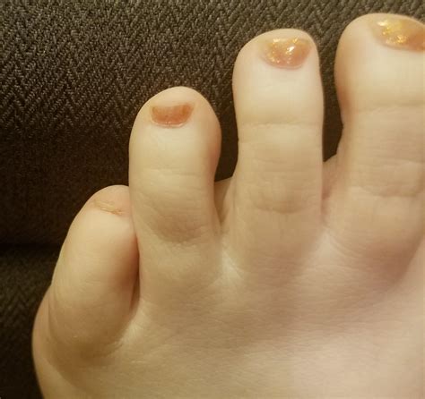 What the heck can I do with my tiny pinky toe nails when I ... Thank you so much @pinkytoes_ph for this!