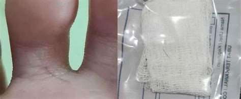 Sebelum ini, saya sering merasakan kesakitan di kaki saya atau hak kanan setiap kali saya bangun. Sering Sakit Sejak Pindah Rumah, Doktor Akhirnya Terpaksa ...