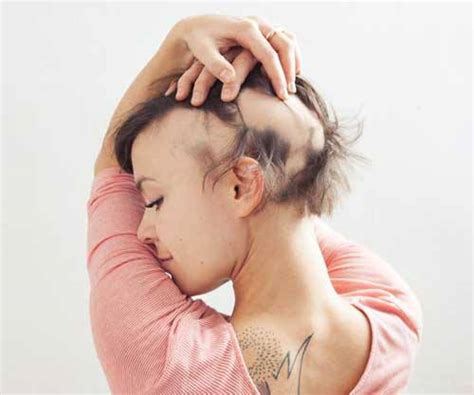 The other is poor nutrition and circulation on the top of the head. Contro l'alopecia niente più scomode parrucche con Look ...