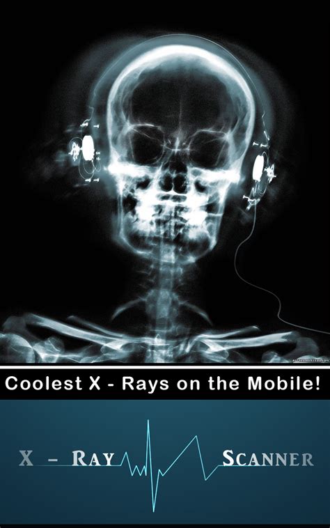 Maybe you would like to learn more about one of these? Xray Scanner: Amazon.co.uk: Appstore for Android