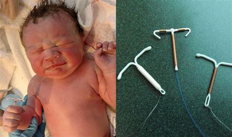 How to take care of a preemie born at 32 weeks. Baby boy born with Mother's birth control device in hand ...