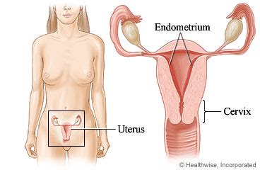 Or does it take a few hours or even days for the egg to attach? Not a bloody mess: Some thoughts on endometrial ablation ...