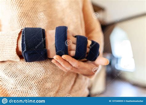Position patient with the forearm of the injured side across the chest with the fingers pointing towards the opposite shoulder. Medicinal arm sling stock image. Image of dexter, bandage ...