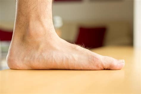 Flat Feet Are More Than Just a Foot Problem : Alliance Foot & Ankle ...
