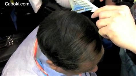 Biomed research international 2014 (2014). Caboki- The amazing Breakthrough for Hair Loss Treatment ...