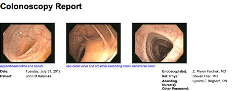 Stool tests should be done every one to three years. Dispatch from the Digital Health Frontier: The Colonoscopy ...