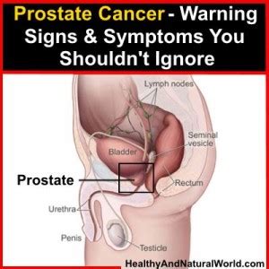 When prostate cancer grows large enough, it begins to fill the prostate and often can be felt by your doctor during. Prostate Cancer - Warning Signs and Symptoms You Shouldn't ...