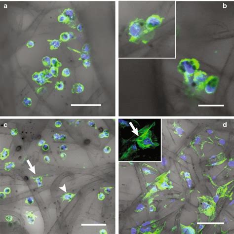 In this chapter, we will learn about. Detection of magnetically-collected cells within scaffolds ...