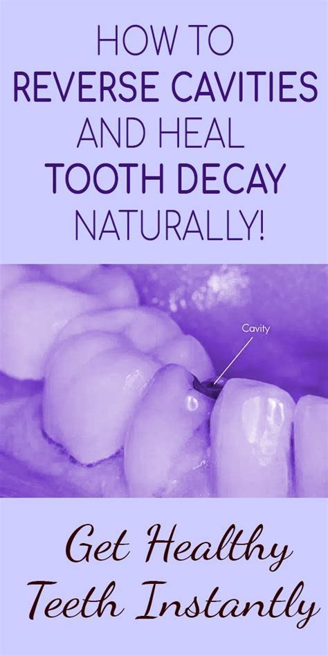 Studies from multiple dental schools have confirmed that an ancient ayurvedic herbal remedy called triphala prevents dental decay by naturally reducing oral bacteria that cause plaque, gingivitis and tooth decay. #toothfairytimeImmense Cosmetic Dentistry Internet # ...