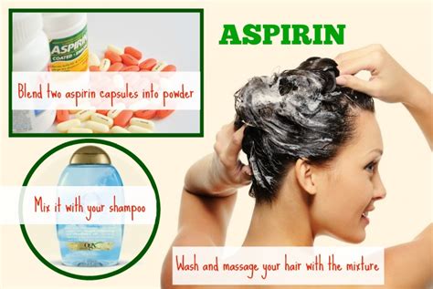 Symptoms include flaking and sometimes mild itchiness. dandruff-Aspirin - Wiki Health
