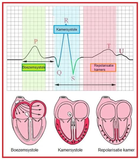 Best of cassi on ecg(15 min). ECG