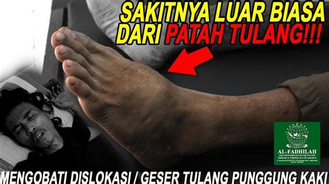 Ini 3 cara mudah mengatasinya. SAKIT BANGET!! GESER TULANG KAKI RETAK + CEDERA ANKLE ...