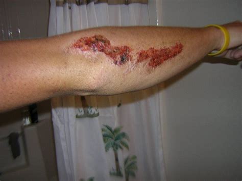 We did not find results for: Motorcycle Road Rash | Pictures