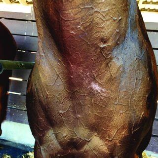The vascular supply of the head showing the anatomical ...