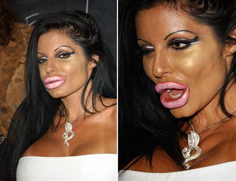 Plastic surgery is intended to correct dysfunctional areas of the body and is reconstructive in nature. Plastic Surgery Gone VERY VERY Wrong…(14 Pics)