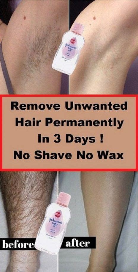 If you want a permanent solution, laser hair removal is pretty much the only option. Remove Unwanted Hair Permanently In Three Days , No Shave ...