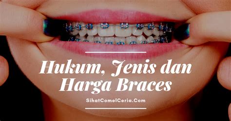 Banyak sekali yang sudah tersedia tempat penjualan ikan arwana khususnya super red ini, sobat bisa mencari tau pada lokasi terdekat daerah asal. Nad's Braces Journey - Before Decide Pakai Braces - Hukum ...