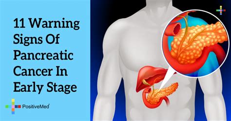 The condition has been associated with cats ingesting poisons, contracting parasitic infections or experiencing trauma like a car accident. 11 Warning Signs Of Pancreatic Cancer In Early Stage