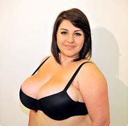 Aislive site reduction (read 7482 times). Female Breast Reduction (Mammaplasty) Information