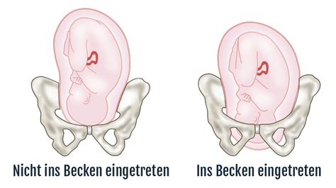 Der gebärmutterhals verkürzt sich, der muttermund öffnet sich. Wie fühlen sich Wehen an? So kannst Du Wehen erkennen ...