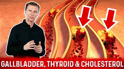 You may often see that various pet foods will make claims like complete and balanced or 100% nutritious. The Gallbladder, Thyroid, and Cholesterol Connection | Dr ...