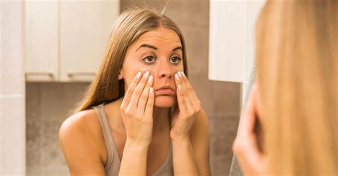 Why do I wake up with puffy eyes in the morning?