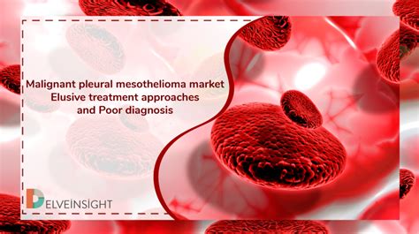 Resources for hcps · dosing information · fda approved Malignant pleural mesothelioma market: Elusive treatment ...