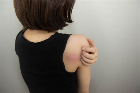 【妊娠中の痒み・原因と対策】かゆい原因は血の不足かも ...