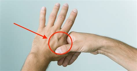 Operasi jika cara lainnya tidak berhasil, cara terakhir yang bisa dilakukan untuk mengatasi telapak tangan berkeringat adalah operasi. Rahsia urut jari tangan, cara ketahui dan kurangkan ...