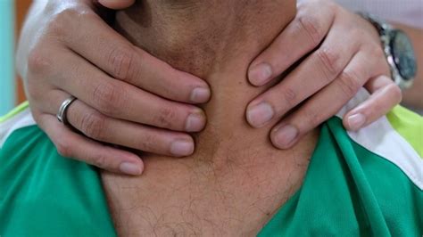 Kenali fungsi hingga beragam kondisi yang bisa terjadi pada mengenal kelenjar pituitari yang mengendalikan beragam fungsi tubuh. Etiologi Tirotoksikosis - Alomedika