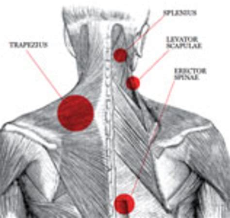 Learn about neck muscles with free interactive flashcards. Belayer's Neck | Muscle diagram, Diagram, Muscle