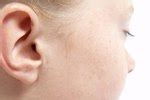 Ear popping causes how to pop ears safely faqs. How to Stop Your Ears From Popping in an Airplane | USA Today