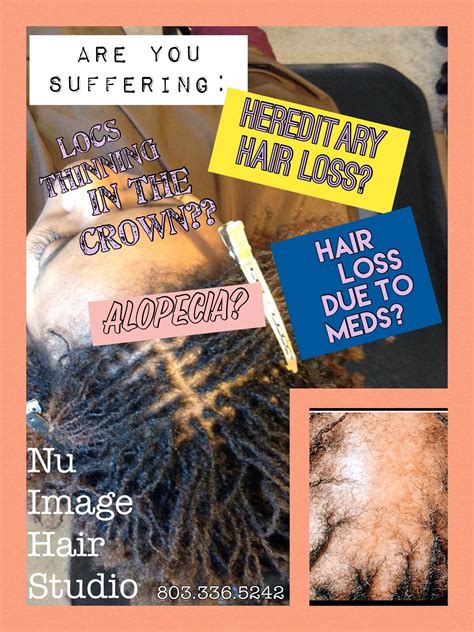 Scientists at columbia university recently discovered a way to grow human hair. Pin on Sisterlocks