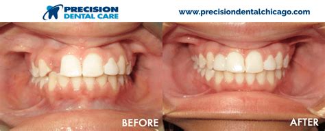 We did not find results for: Precision Dental Care | The Best Dentists in Chicago IL