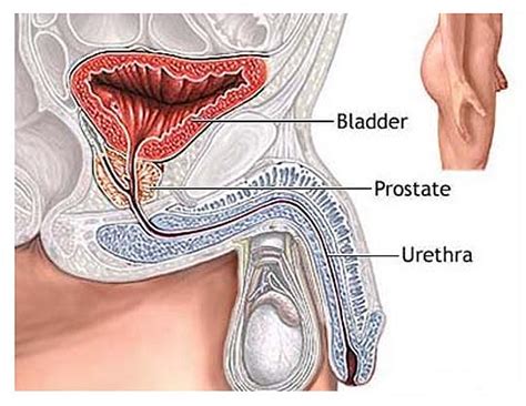 What are the symptoms of bladder cancer? Symptoms of Bladder Cancer
