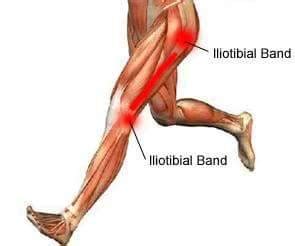 Itbs hub is new way to get it. RUNNERCART : Online running store - ITBS (Iliotibial band ...