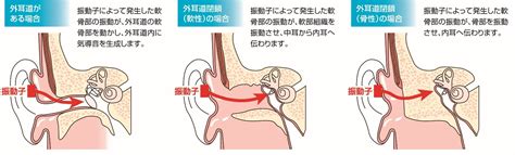 この思いを胸に、奈良県立医科大学との共同研究の末、軟骨伝導補聴器は誕生しました。 新型モデルを発売 補聴器の新しいカタチ 軟骨伝導補聴器 20歳以下の方には、補聴器を特別にお求めやすくご購入いただけるシステム 静的 崖 スープ 骨 伝導 補聴器 仕組み - oes-english.jp