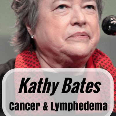 Kathy bates is an actress who has starred in such a long list of films, it's no surprise that she earned a star on the hollywood walk of fame. Dr Oz: Kathy Bates Cancer & Lymphedema + Soda Alternatives