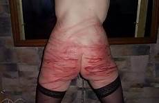 spanking marks