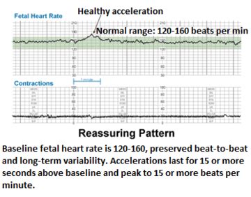 Angkanya bisa bervariasi tergantung detak jantung normal setiap individu. nurulnadiah: Kadar Degupan Jantung Bayi / Apakah CTG ...