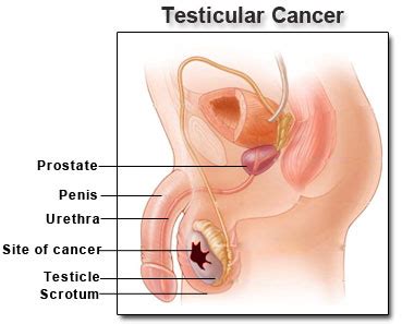 Despite their tough exterior, cancer, born between june 21 and july 23 and also known as moon children, tend to be the most extraordinarily. Cancer Center at Gaithersburg » Testicular Cancer