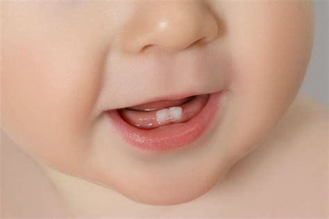 Im normalfall taucht der erste zahn um den sechsten lebensmonat. Wann bekommen Babys die ersten Zähne?