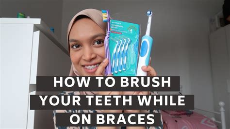 Brushing your teeth is extremely important when you wear braces, as you don't want food particles to get stuck. How to brush your teeth while on braces - YouTube