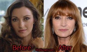 Fortunately, the process of most surgeries looked done well. Jane Seymour Plastic Surgery, Before and After Botox Pictures