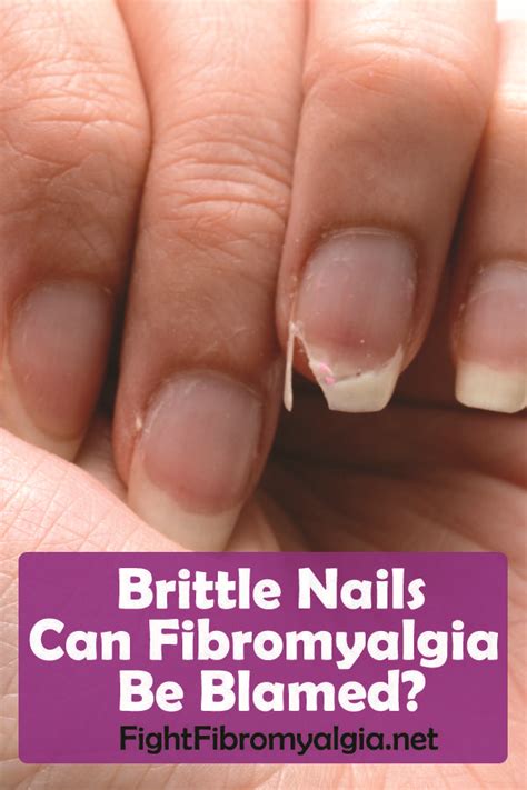 For especially strong, health nails you can eat gelatin , which will also benefit your hair. Brittle Nails: Can Fibromyalgia Be Blamed? - #blamed # ...