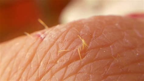 While the big spiky needles are more painful, they are easy to remove since you can usually grab them with tweezers or finger nails and pull them out. Little cactus spines removal. - YouTube